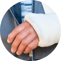 Man with arm in cast needing accident insurance.